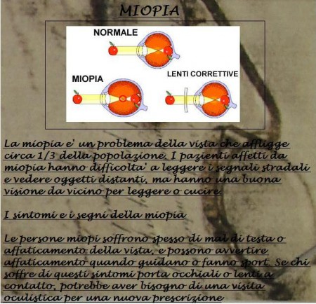 MIOPIA